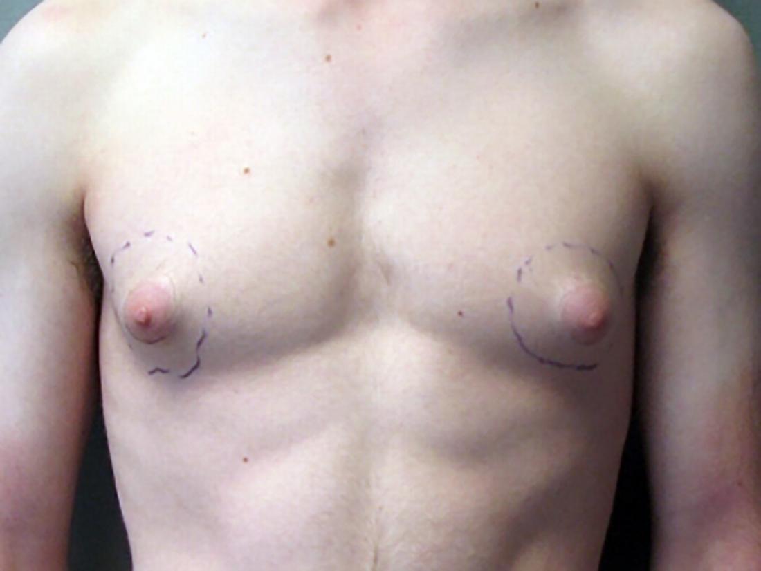 anthony gotto add Cute naked dudes photo
